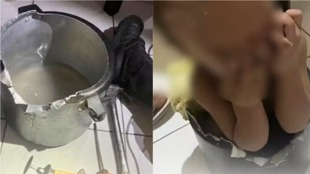 Bombeiros resgatam menino de 1 ano preso em panela de pressão no Ceará