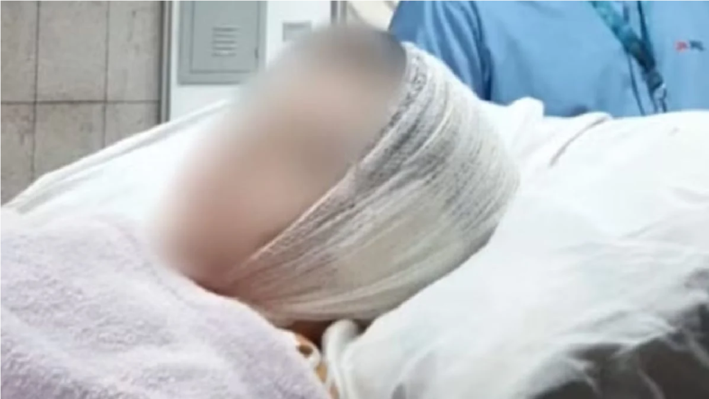 Menino de oito anos é atacado por pitbull da família e perde parte da orelha em Ribeirão das Neves